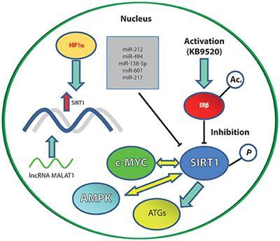 SIRT1 in Secretory Organ Cancer